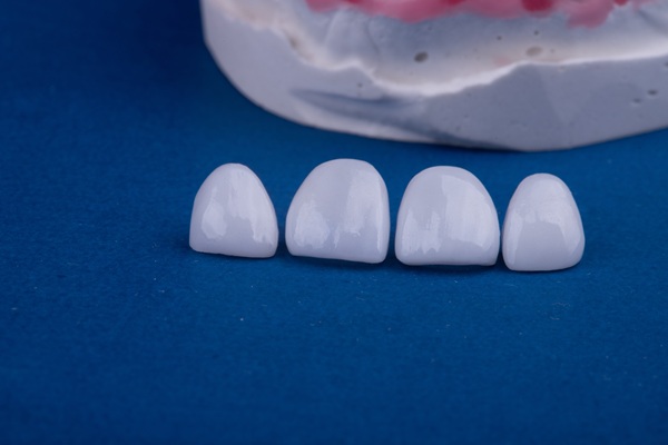 What To Ask At A CEREC Crown Consultation