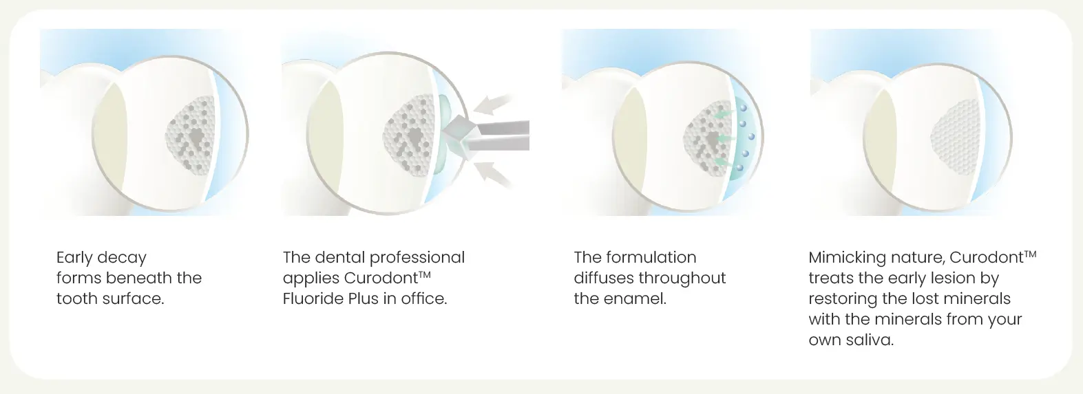 curodont-infographic