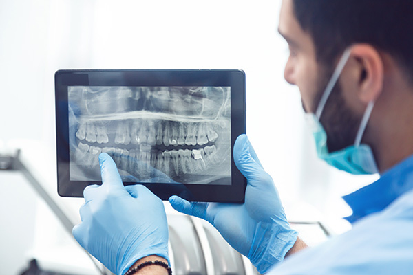 General Dentistry: Are Dental X-rays Recommended? from Eagle Rock Family Dentistry in Los Angeles, CA