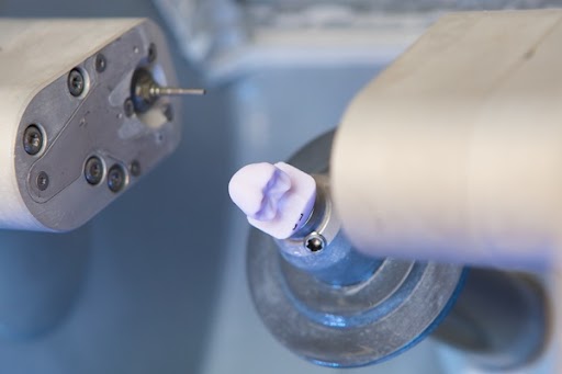Same Day Crown Technology Overview For Dental Patients